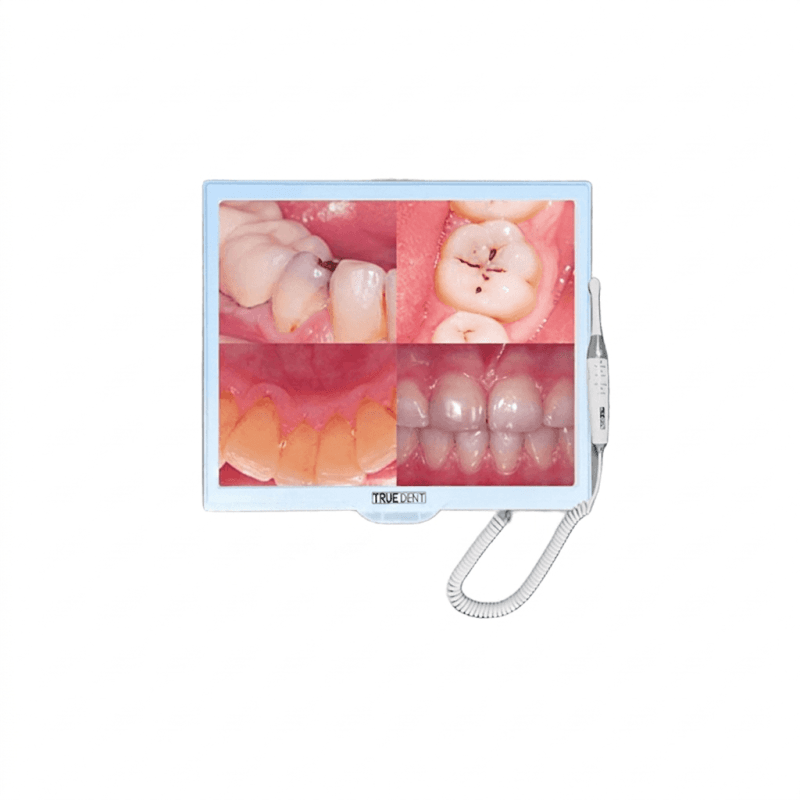 Truedent Intraoral Camera With Screen