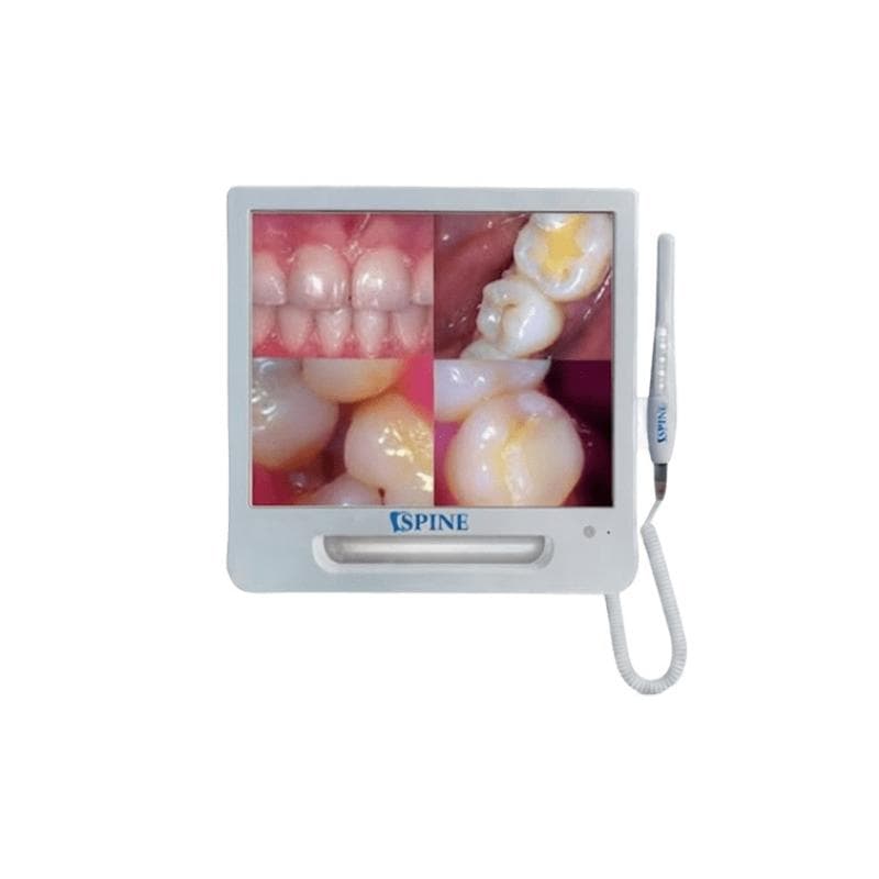 Spine Pro Intraoral Camera