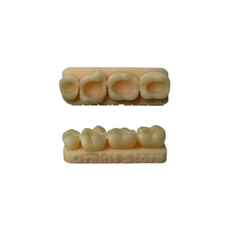Composite Kit Class 1 Model