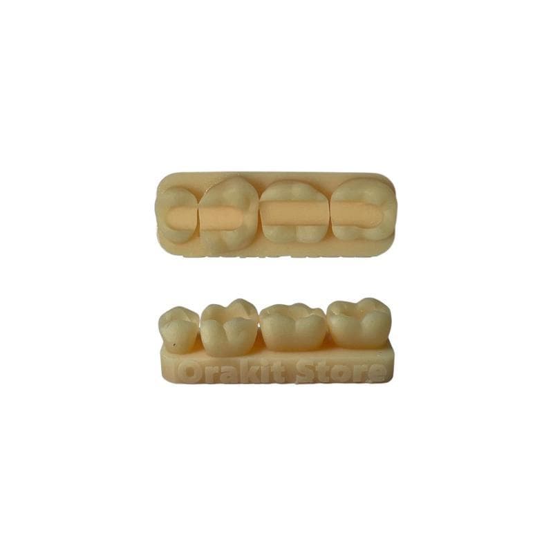 Composite Kit Class 2 Model