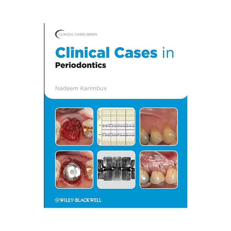 Clinical Cases In Periodontics